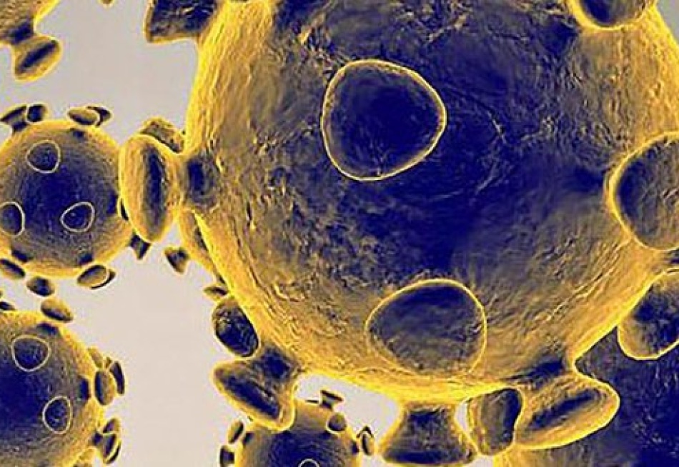 Brasil registrou 1.131 mortes e 68.138 exames positivos da Covid-19 nas últimas 24 horas