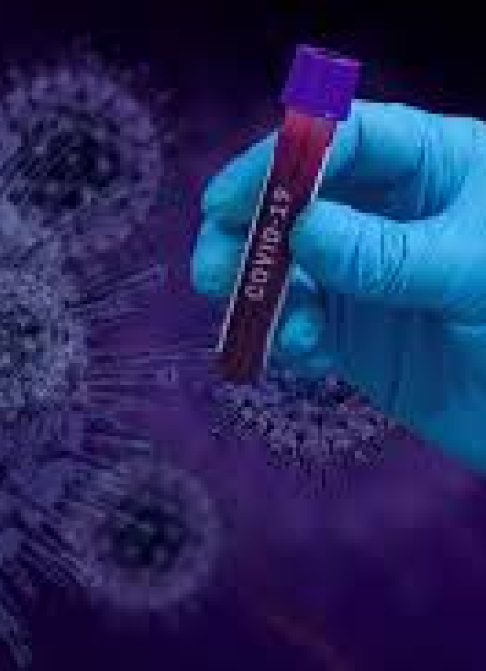 Pará de Minas já registrou 75 mortes pela Covid-19