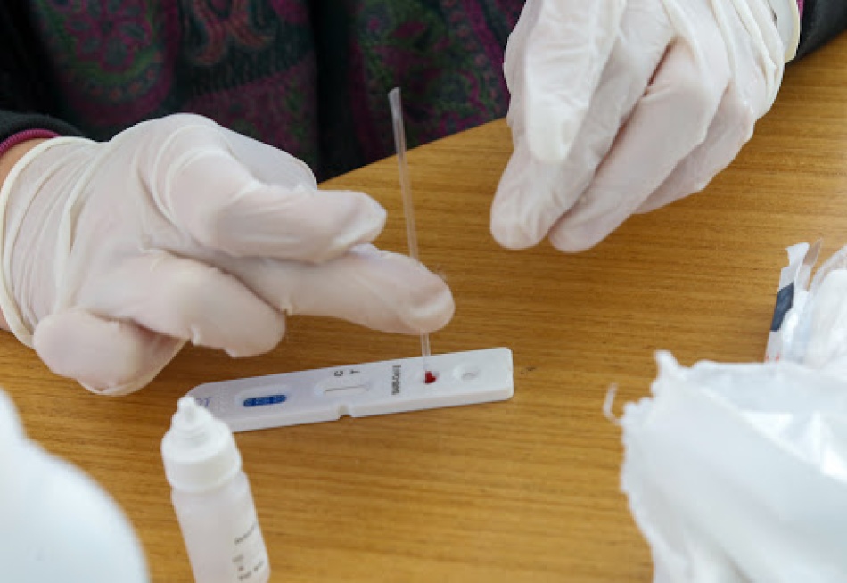 Ministério da Saúde confirmou primeiro caso de reinfecção pela Covid-19 no Brasil
