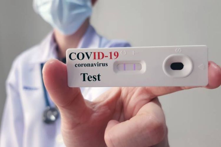 Farmácias brasileiras apresentam recorde de testes e resultados positivos para a Covid-19