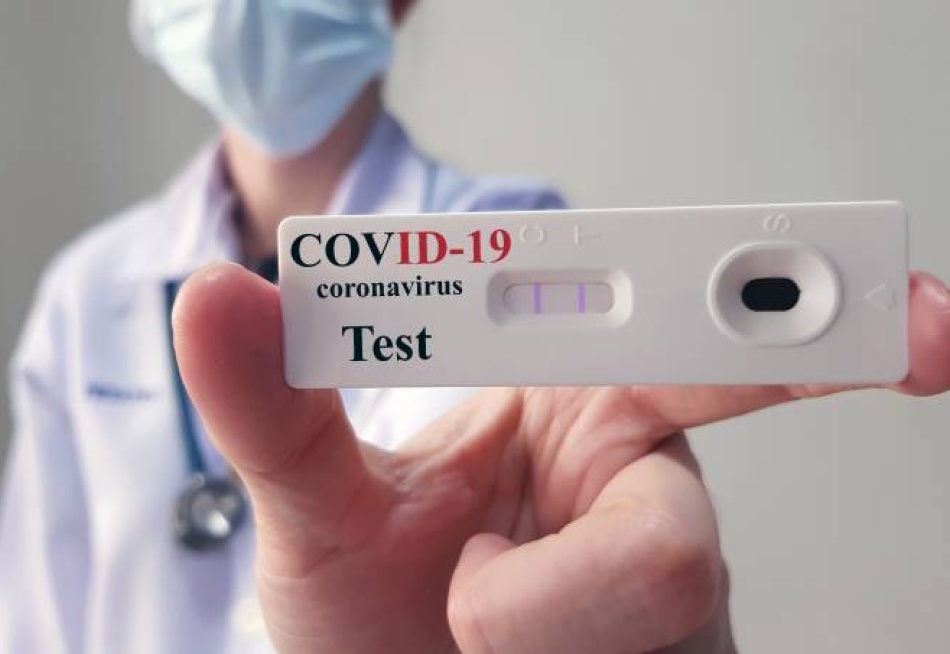 Farmácias brasileiras apresentam recorde de testes e resultados positivos para a Covid-19