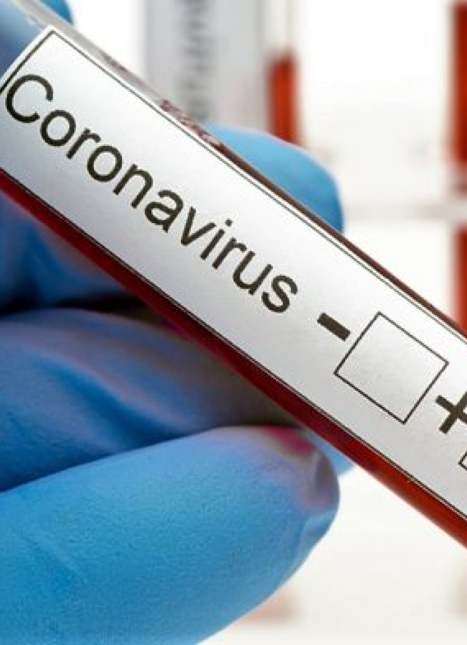 Pará de Minas registrou cinco novos casos confirmados da Covid-19 nas últimas 24 horas