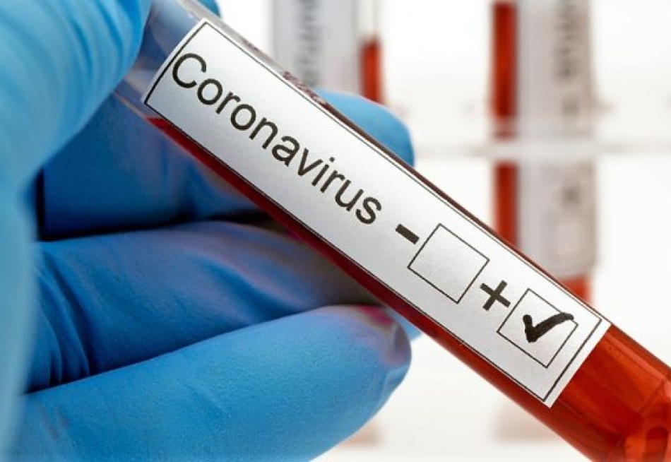 Pará de Minas registrou cinco novos casos confirmados da Covid-19 nas últimas 24 horas