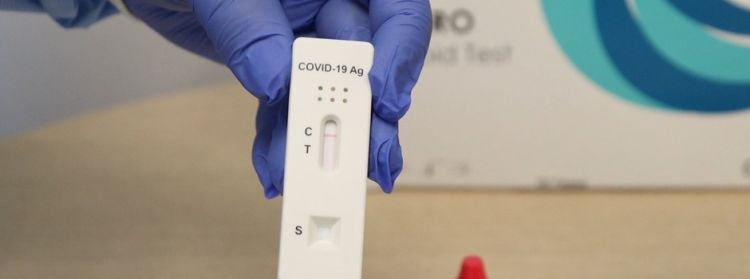Pará de Minas vai receber do Ministério da Saúde 3.610 testes rápidos para Covid-19